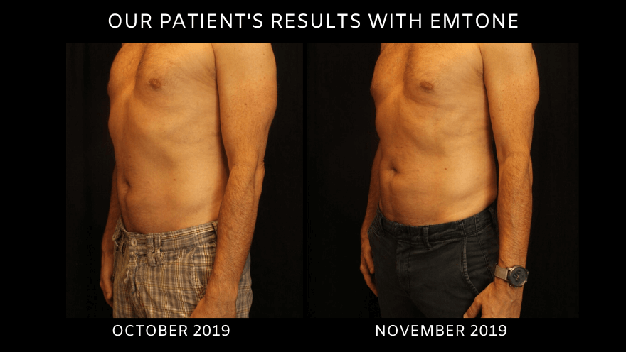 The Body Clinic Patient EMtone